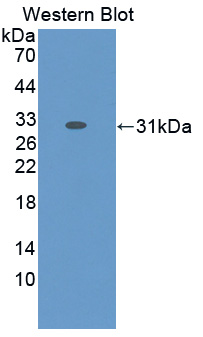 Polyclonal Antibody to Glycine Dehydrogenase (GLDC)