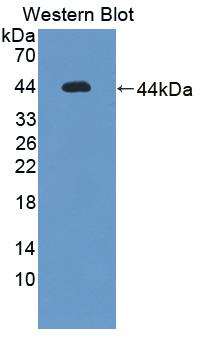 Polyclonal Antibody to Uroporphyrinogen Decarboxylase (UROD)