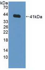 Polyclonal Antibody to Farnesyltransferase Alpha (FNTa)