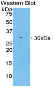 Polyclonal Antibody to V-Yes-1 Yamaguchi Sarcoma Viral Related Oncogene Homolog (LYN)