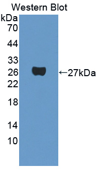 Polyclonal Antibody to Phosphoprotein Associated With Glycosphingolipid Microdomains 1 (PAG1)