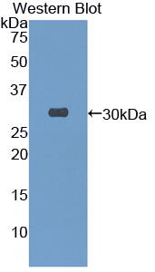 Polyclonal Antibody to Torsin 3A (TOR3A)