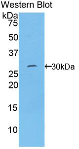 Polyclonal Antibody to Torsin 1B (TOR1B)