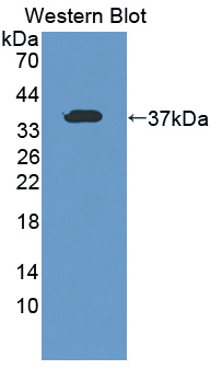 Polyclonal Antibody to Torsin 1A (TOR1A)