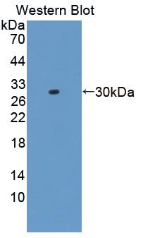 Polyclonal Antibody to Breast Cancer Anti-Estrogen Resistance 1 (BCAR1)