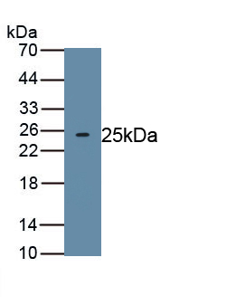 Polyclonal Antibody to Thyroid Transcription Factor 1 (TITF1)