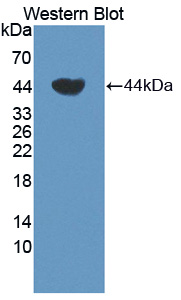 Polyclonal Antibody to Transcobalamin I (TCN1)