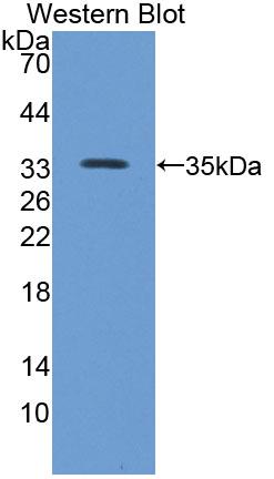 Polyclonal Antibody to Talin 2 (TLN2)