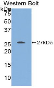 Polyclonal Antibody to Transforming Growth Factor Beta 1 Induced Transcript 1 (TGFb1I1)