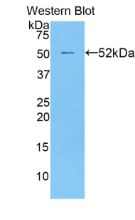 Polyclonal Antibody to Transcription Factor A, Mitochondrial (TFAM)