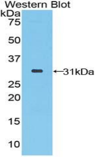 Polyclonal Antibody to STAM Binding Protein (STAMBP)