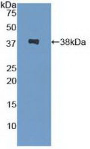 Polyclonal Antibody to Serine Peptidase Inhibitor Kazal Type 1 (SPINK1)