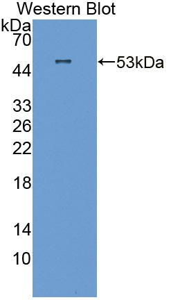 Polyclonal Antibody to Semenogelin I (SEMG1)