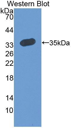 Polyclonal Antibody to Reticulocalbin 2 (RCN2)