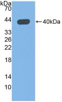 Polyclonal Antibody to Glutaminyl Peptide Cyclotransferase (QPCT)