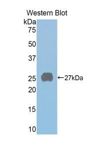 Polyclonal Antibody to Prolactin Receptor (PRLR)