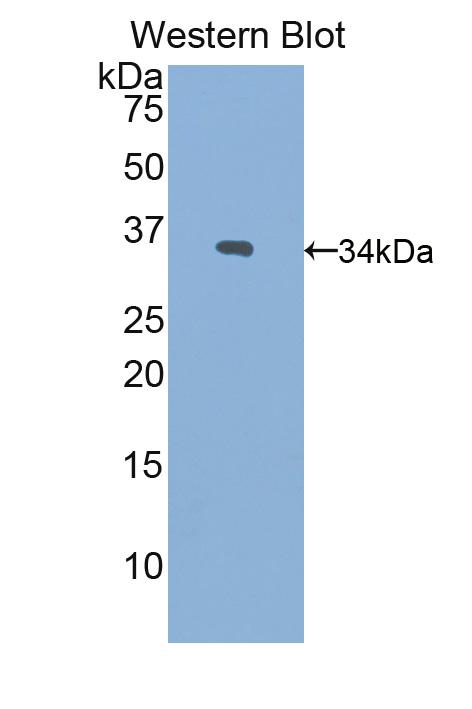 Polyclonal Antibody to Paraneoplastic Antigen MA2 (PNMA2)