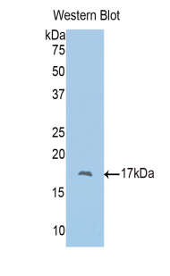 PAH437Hu02.jpg