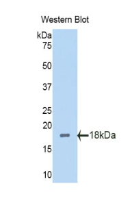 PAH437Hu03.jpg