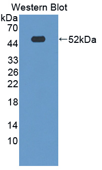 Polyclonal Antibody to Nexilin (NEXN)