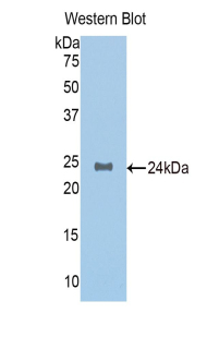 PAH574Hu02.jpg