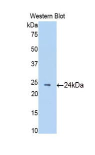 PAH574Ra01.jpg