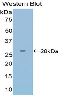 Polyclonal Antibody to Latexin (LXN)