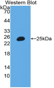 Polyclonal Antibody to Inter Alpha-Globulin Inhibitor H3 (ITIH3)