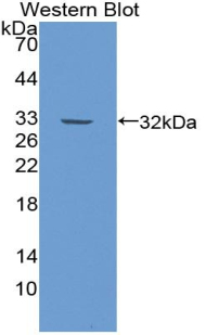 Polyclonal Antibody to Inter Alpha-Globulin Inhibitor H2 (ITIH2)