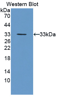 Polyclonal Antibody to Feline Sarcoma Oncogene (FES)