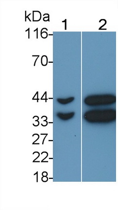 PAJ419Hu01.jpg