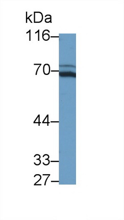 Polyclonal Antibody to Interleukin 21 Receptor (IL21R)