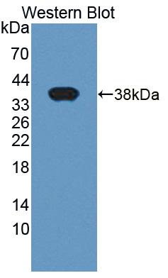 Polyclonal Antibody to LIM And SH3 Protein 1 (LASP1)