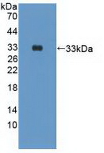 PAJ832Hu01.jpg