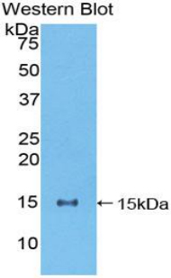 Polyclonal Antibody to Numb Homolog (NUMB)