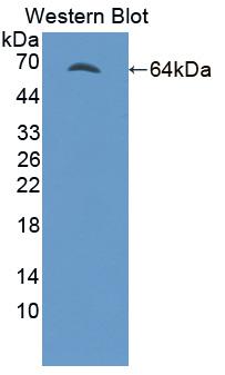 Polyclonal Antibody to FYN Oncogene Related To SRC/FGR/YES (FYN)