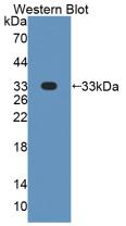 Polyclonal Antibody to Dicer 1, Ribonuclease Type III (DICER1)