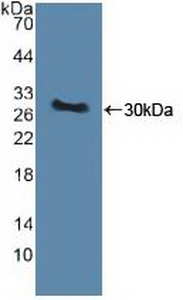 Polyclonal Antibody to PTEN Induced Putative Kinase 1 (PINK1)