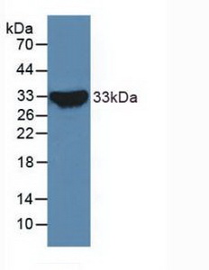 PAL148Hu01.jpg