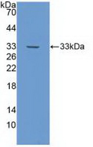 PAL149Hu01.jpg