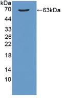 Polyclonal Antibody to Beta-1,3-Galactosyltransferase 5 (b3GALT5)