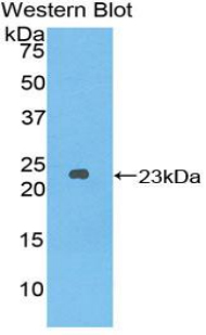 PAL454Hu01.jpg