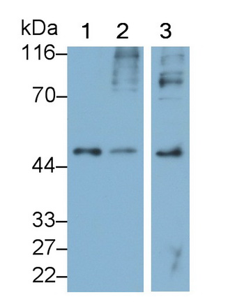 PAL523Hu01.jpg