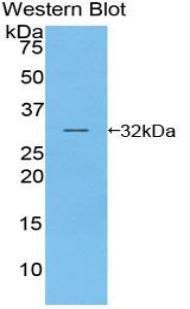 Polyclonal Antibody to Phosphoinositide Kinase, FYVE Finger Containing (PIKFYVE)