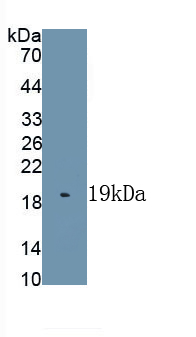 Polyclonal Antibody to Interleukin 1 Family, Member 9 (IL1F9)