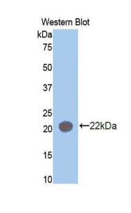 Polyclonal Antibody to Aminoacyl tRNA Synthetase Complex Interacting Multifunctional Protein 1 (AIMP1)