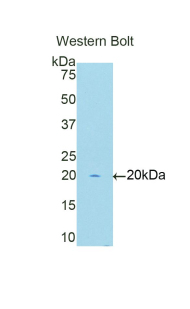 Polyclonal Antibody to V-Myc Myelocytomatosis Viral Oncogene Homolog 1, Lung Carcinoma Derived (MYCL1)