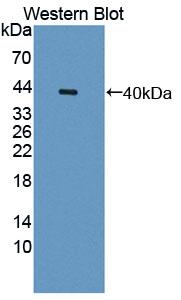 Polyclonal Antibody to Otubain 1 (OTUB1)