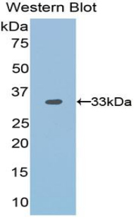 Polyclonal Antibody to Otubain 1 (OTUB1)