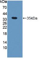 Polyclonal Antibody to Nei Endonuclease VIII Like Protein 1 (NEIL1)